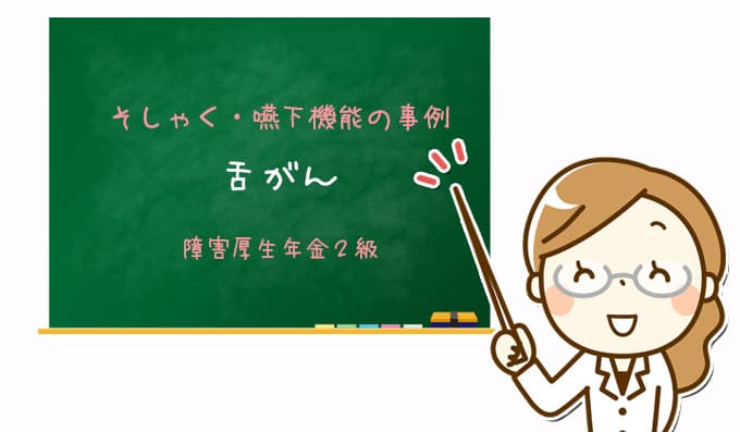 舌がん｜障害厚生年金２級